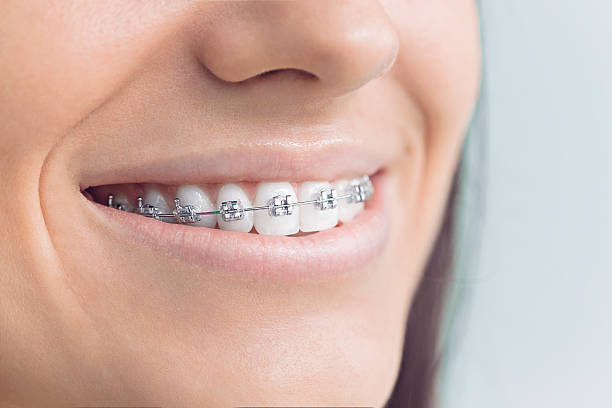 Laser Dentistry in Nanuet, NY